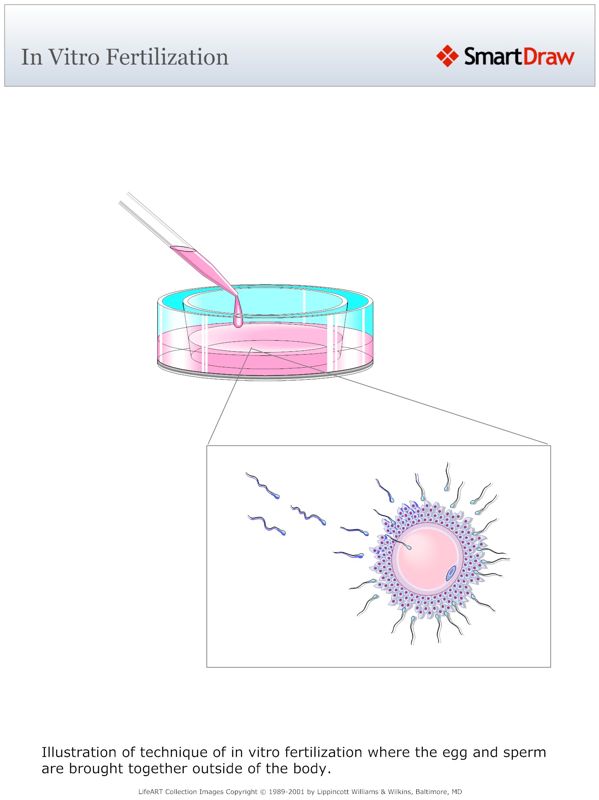 In_Vitro_Fertilization