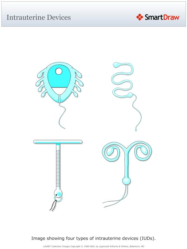 Intrauterine_Devices