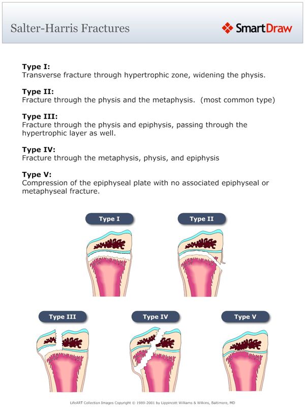 Salter-Harris_Fractures