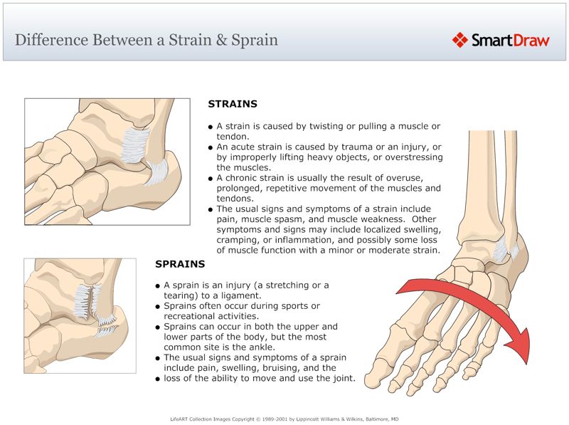 Difference_Between_a_Strain_&_Sprain
