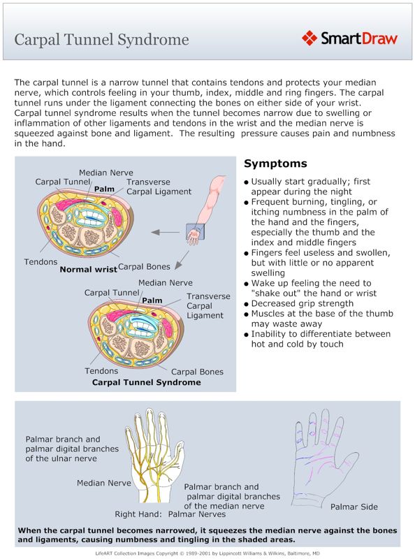 Carpal_Tunnel_Syndrome