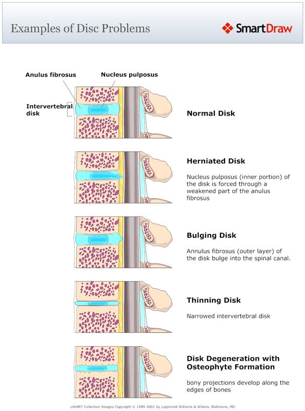 Examples_of_Disc_Problems
