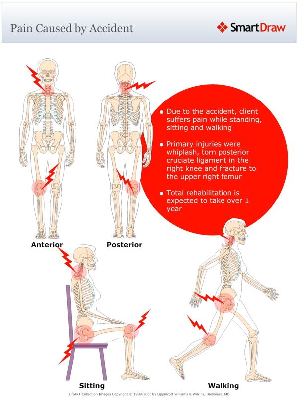Pain_Caused_by_Accident