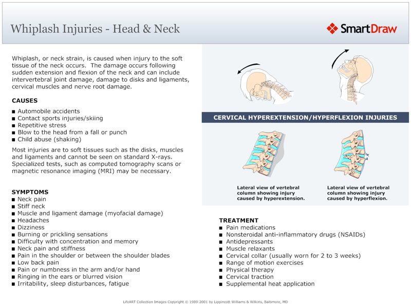 Whiplash_Injuries_-_Head_&_Neck