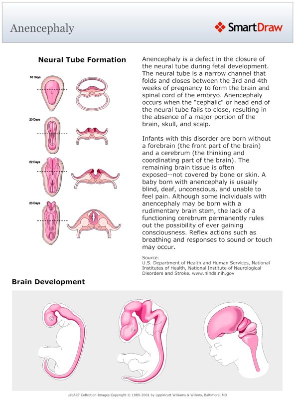 Anencephaly