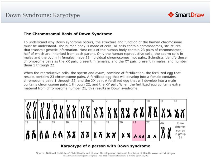 Down_Syndrome_Karyotype