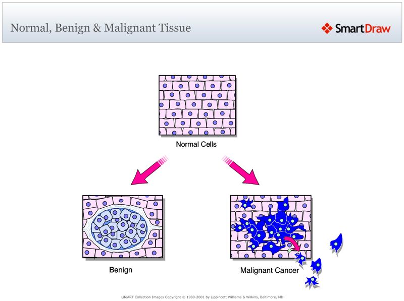 Normal_Benign_&_Malignant_Tissue