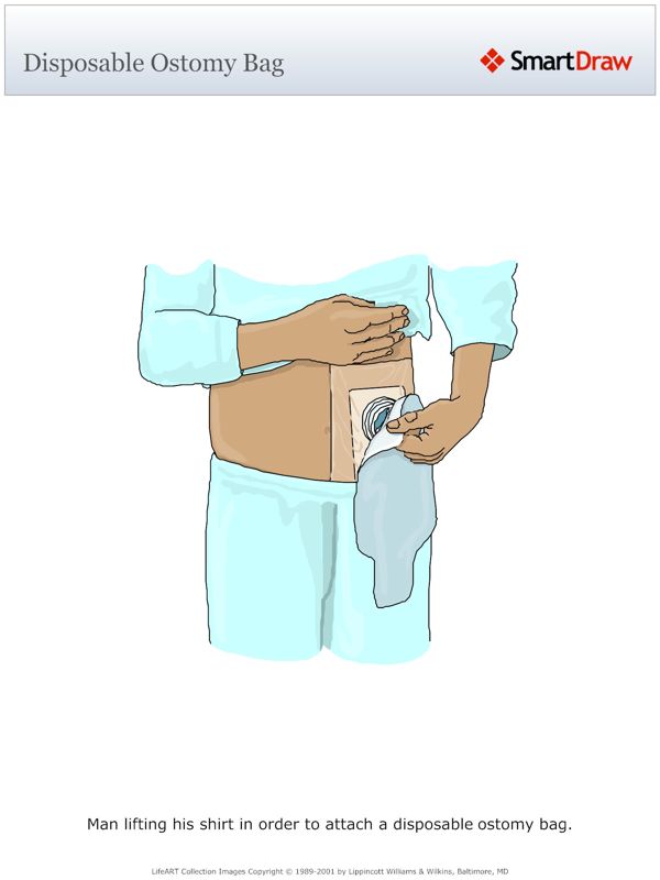 Disposable_Ostomy_Bag