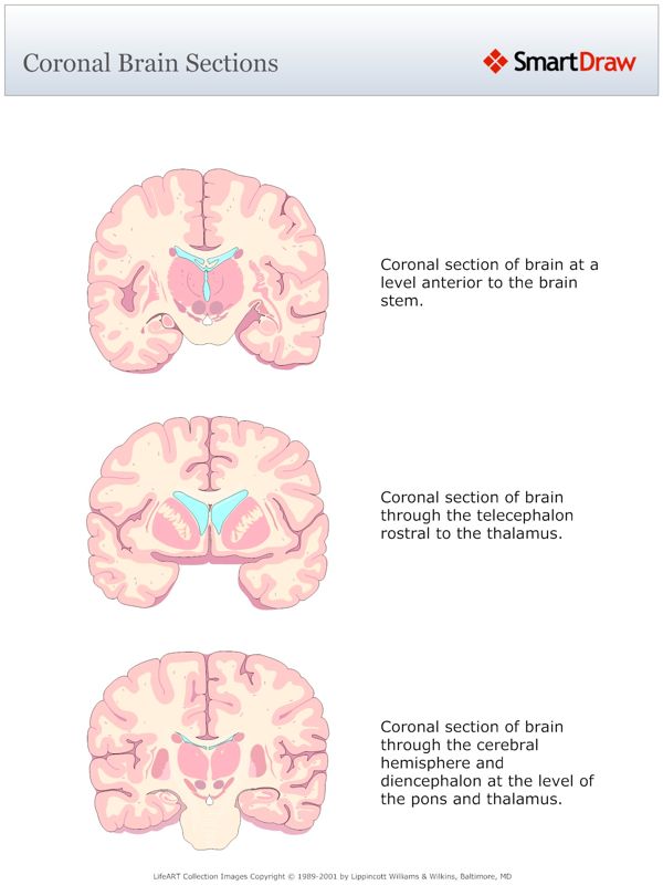 Coronal_Brain_Sections