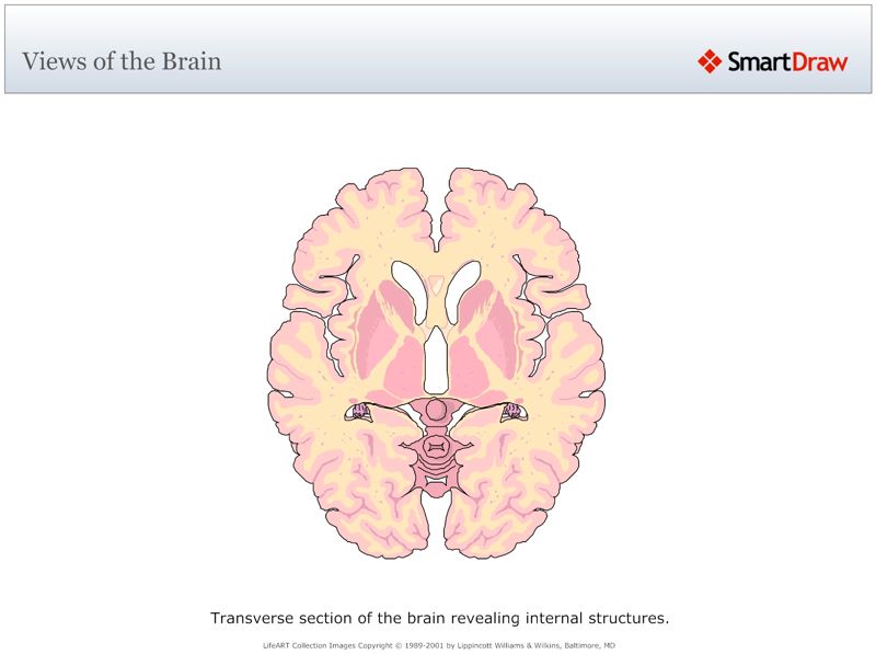 Views_of_the_Brain9