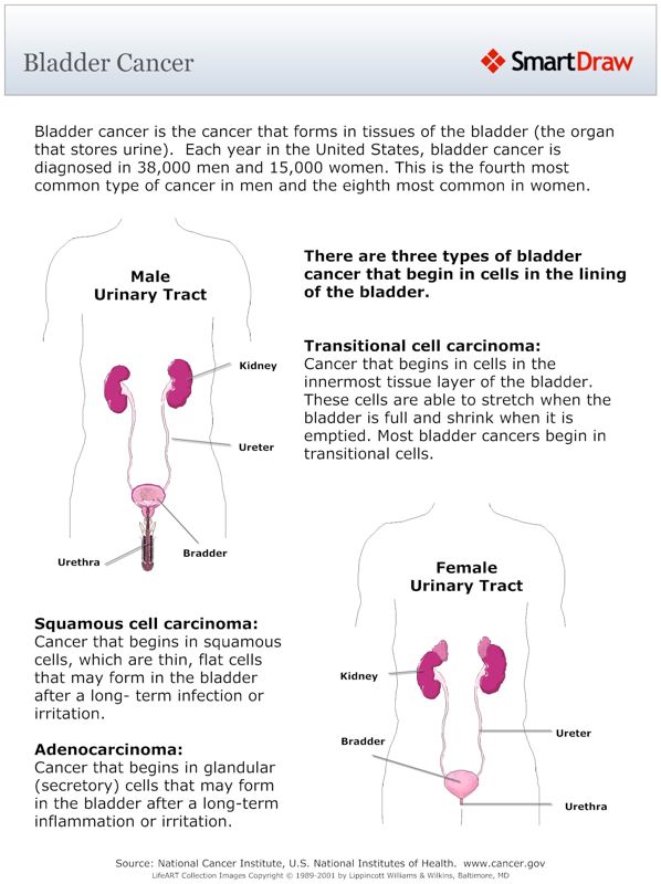 Bladder_Cancer