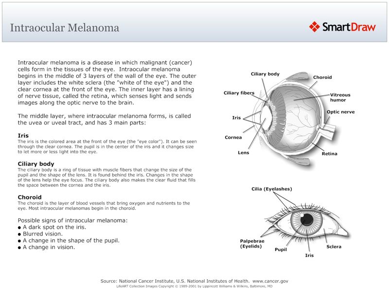 Intraocular_Melanoma