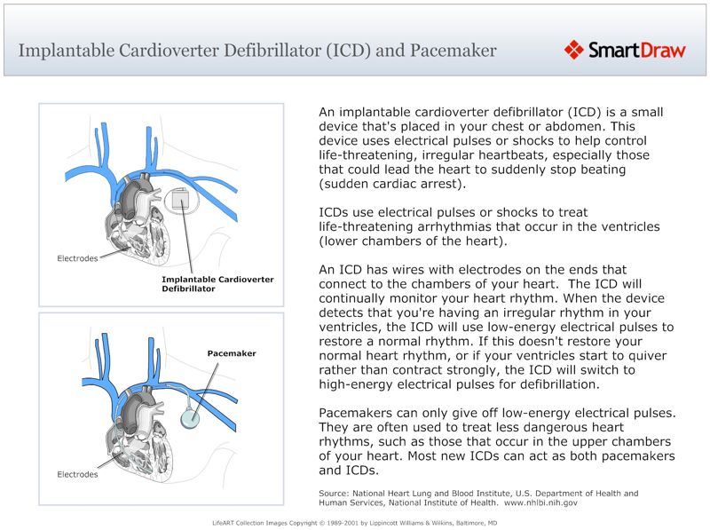 Implantable_Cardioverter_Defibrillator_(ICD)_and_Pacemaker