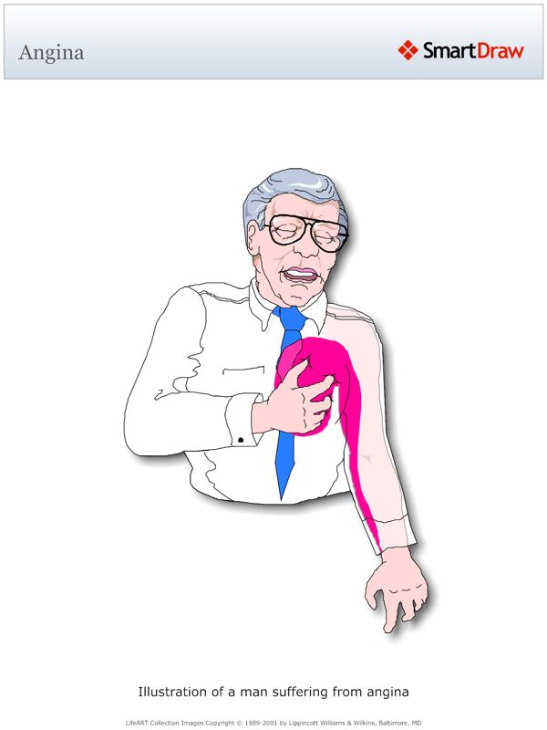 Angina