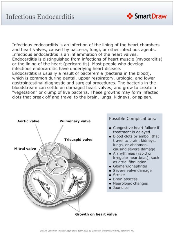 Infectious_Endocarditis