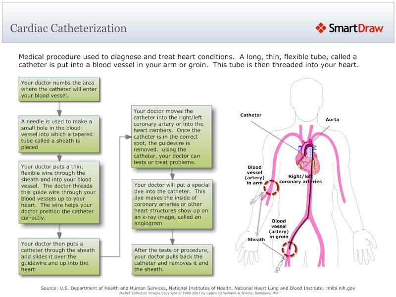 Cardiac_Catheterization