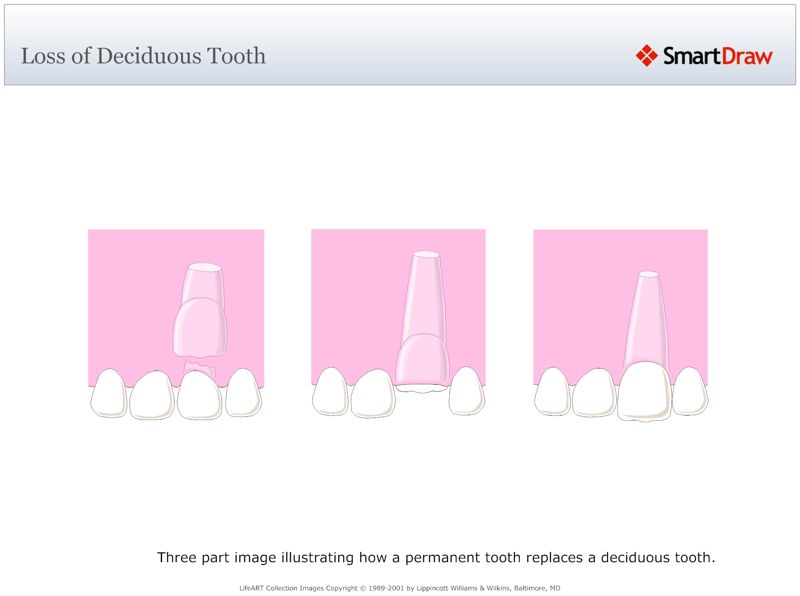 Loss_of_Deciduous_Tooth