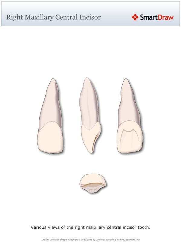 Right_Maxillary_Central_Incisor
