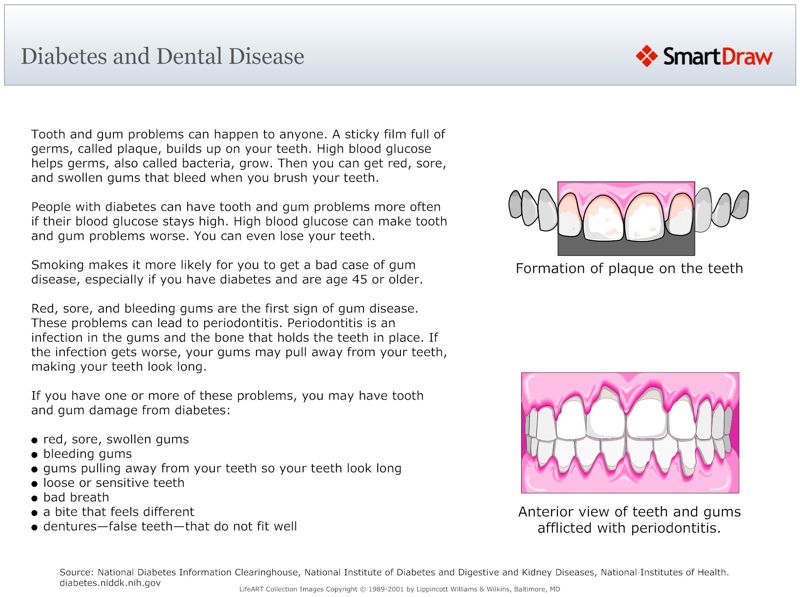 Diabetes and Dental Disease