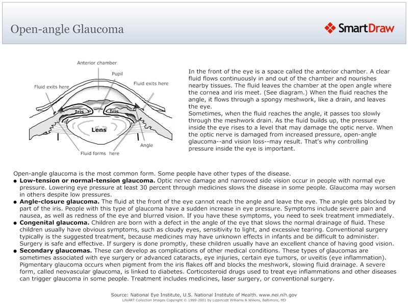 Open-angle Glaucoma
