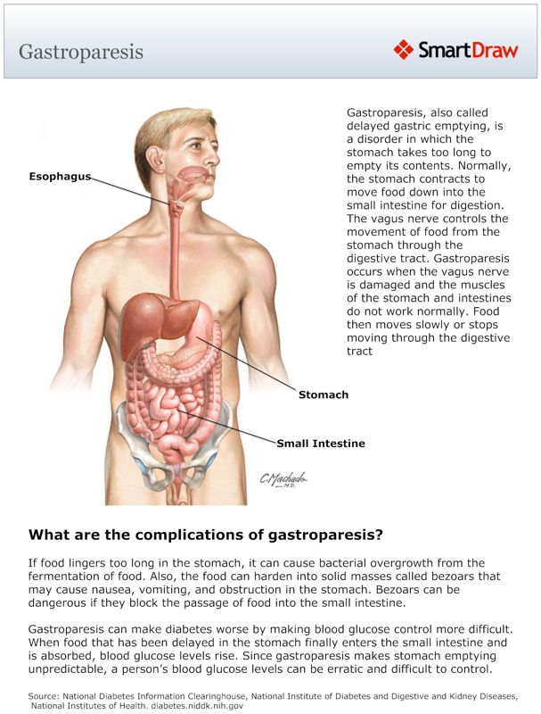Gastroparesis