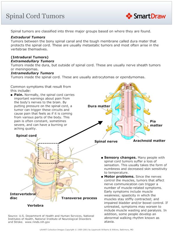 Spinal_Cord_Tumors