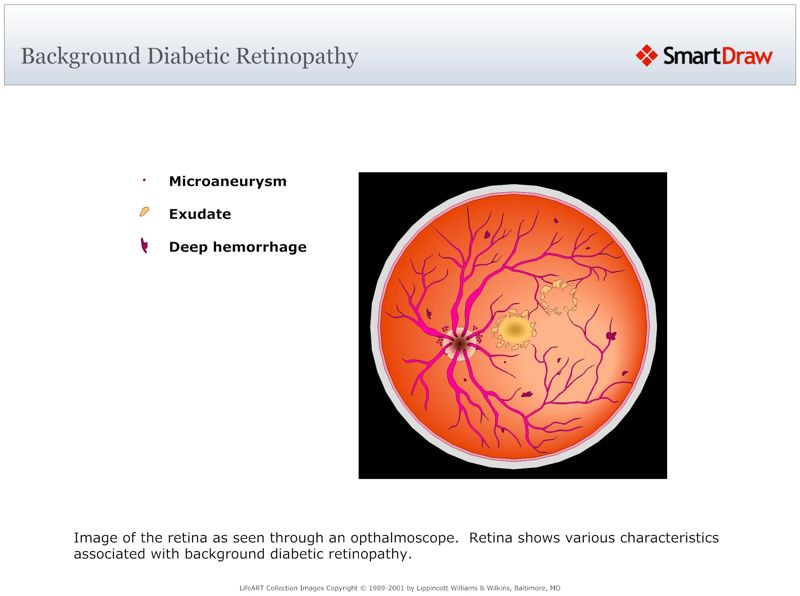 Background Diabetic Retinopathy