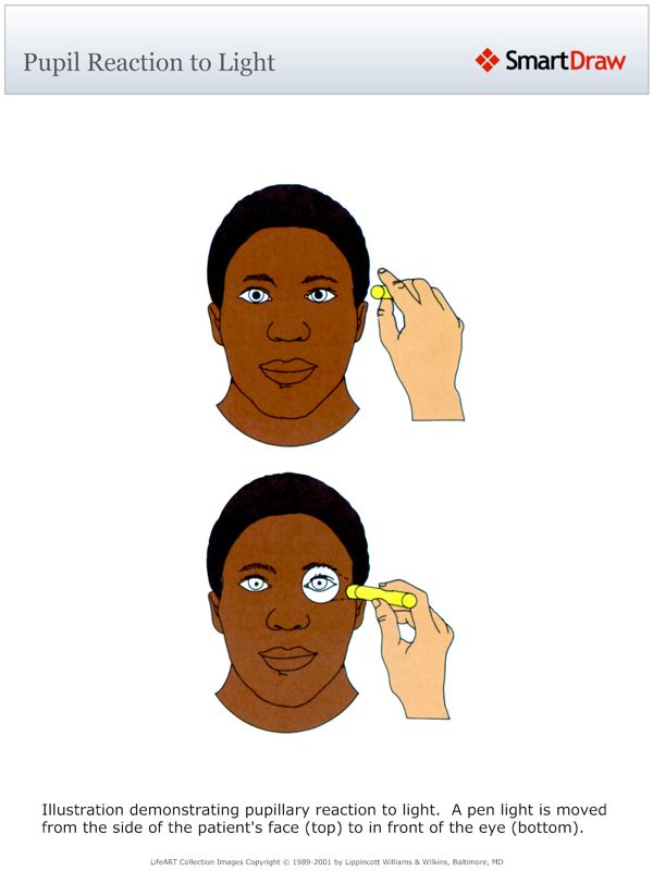 Pupil Reaction to Light