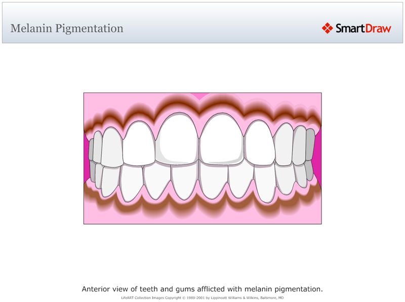 Melanin_Pigmentation
