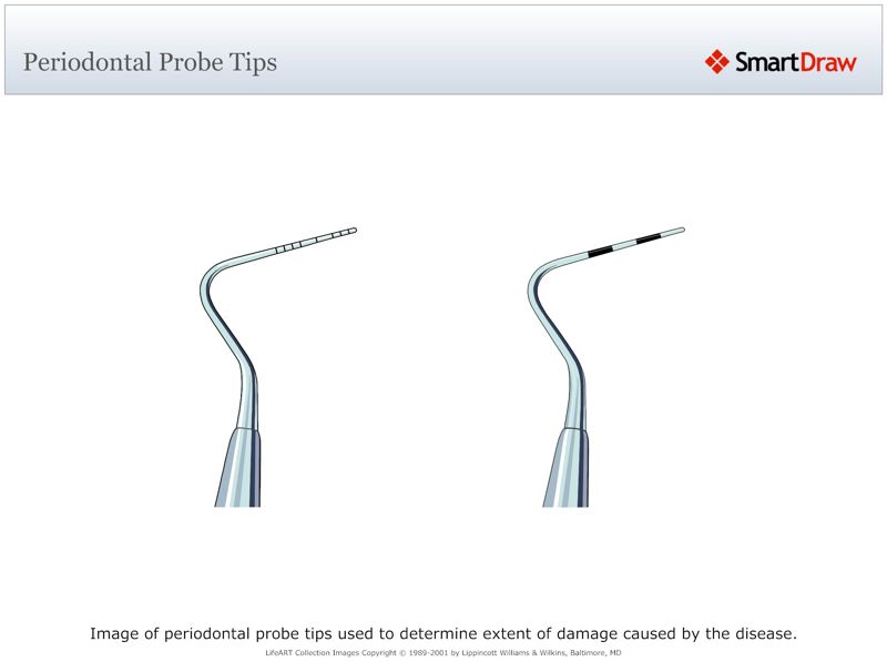 Periodontal_Probe_Tips