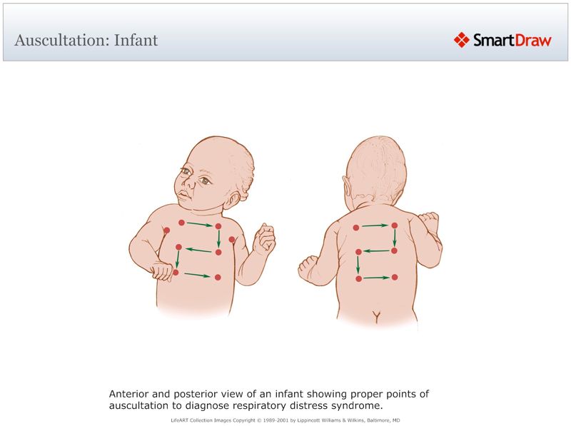 Auscultation_Infant