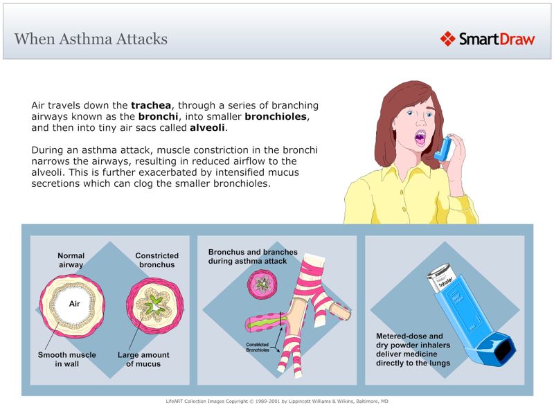 When_Asthma_Attacks