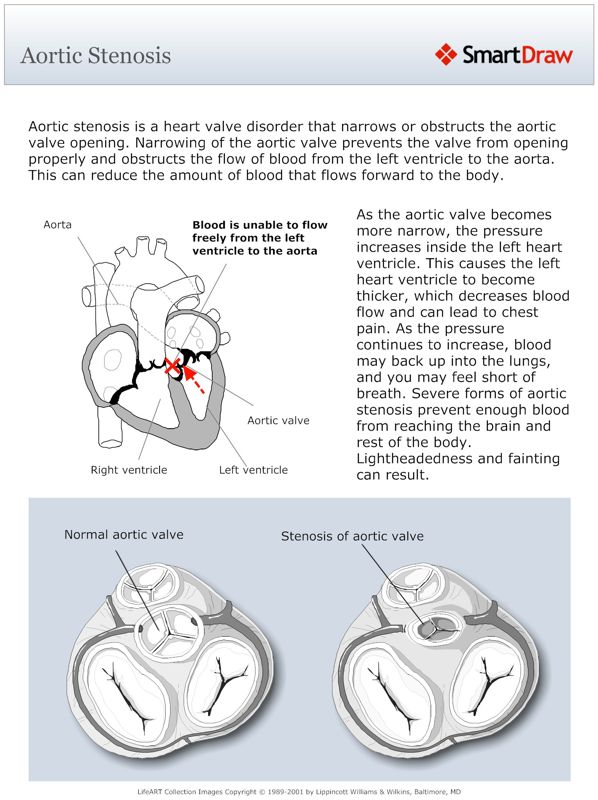 Aortic_Stenosis