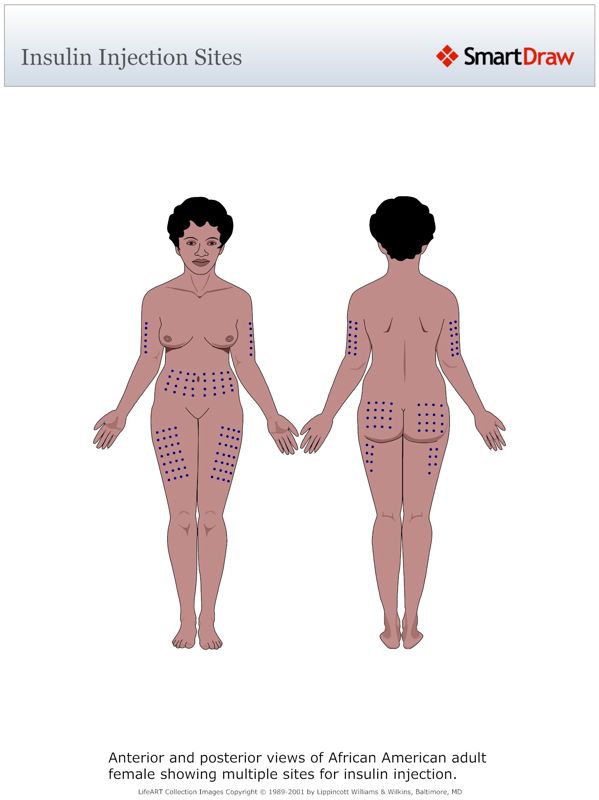 Insulin_Injection_Sites