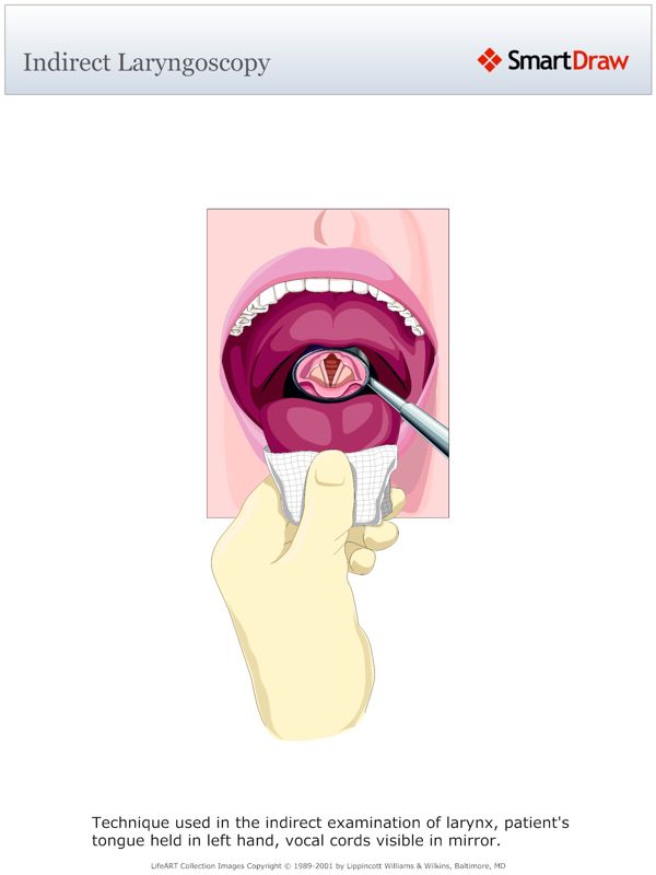 Indirect_Laryngoscopy
