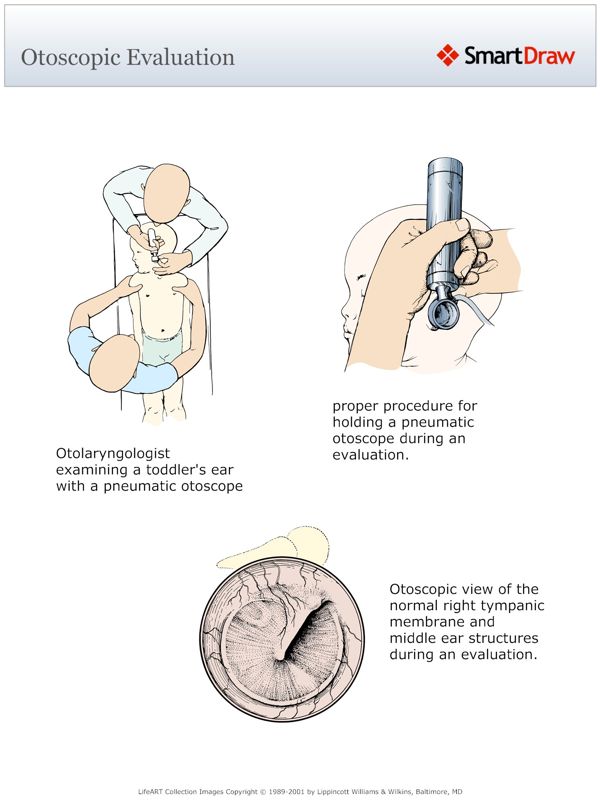 Otoscopic_Evaluation