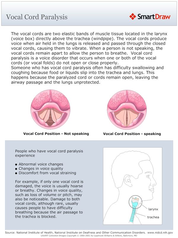 Vocal_Cord_Paralysis