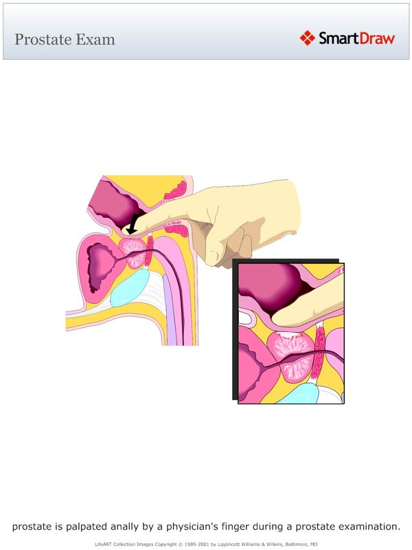 Prostate_Exam