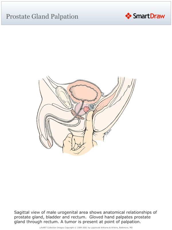 Prostate_Gland_Palpation