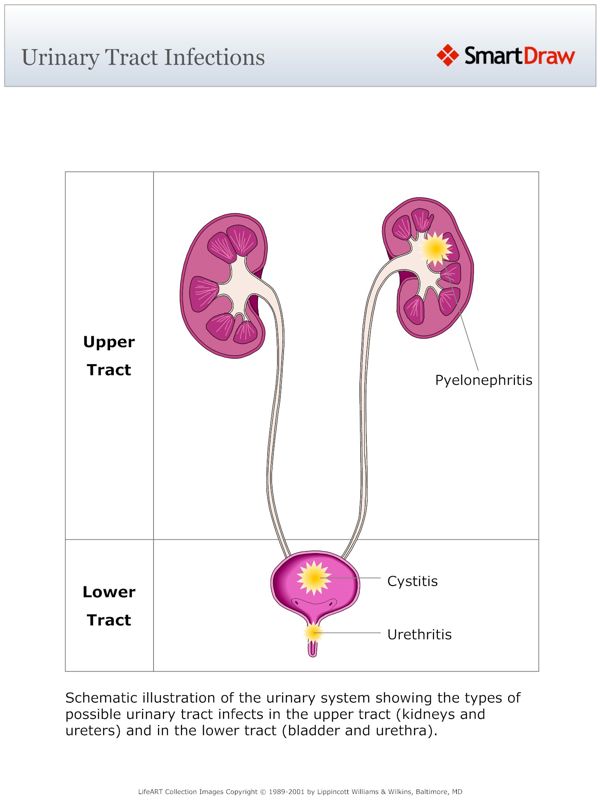 Urinary_Tract_Infections