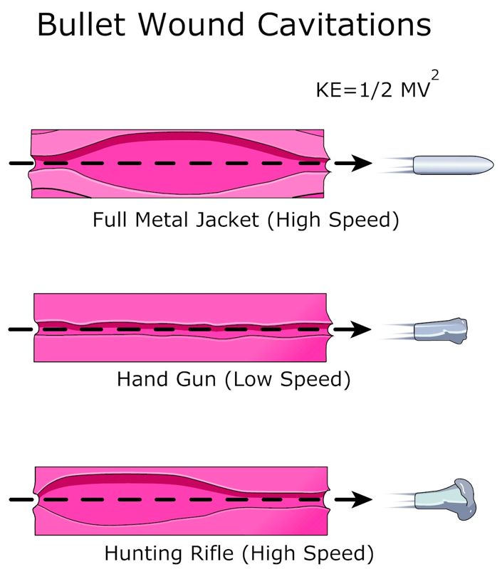 Bullet_Wound_Cavitations