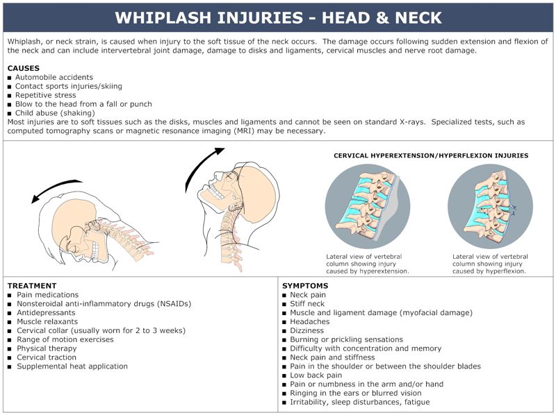 WHIPLASH_INJURIES_-_HEAD_&_NECK