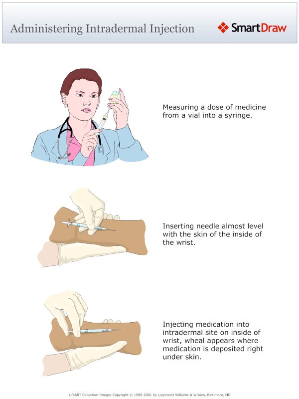 Administering_Intradermal_Injection