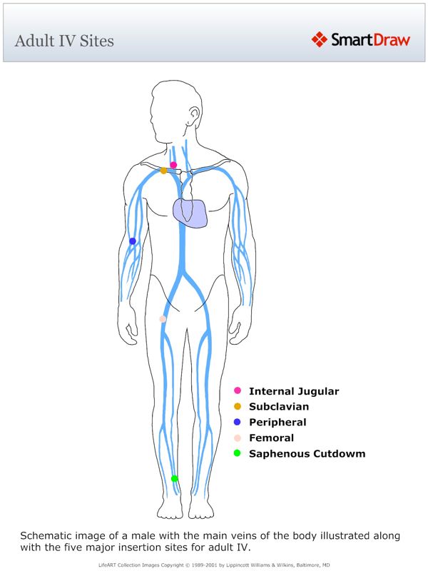Adult_IV_Sites