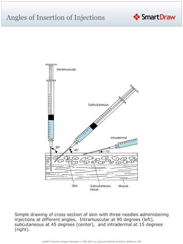 Angles_of_Insertion_of_Injections