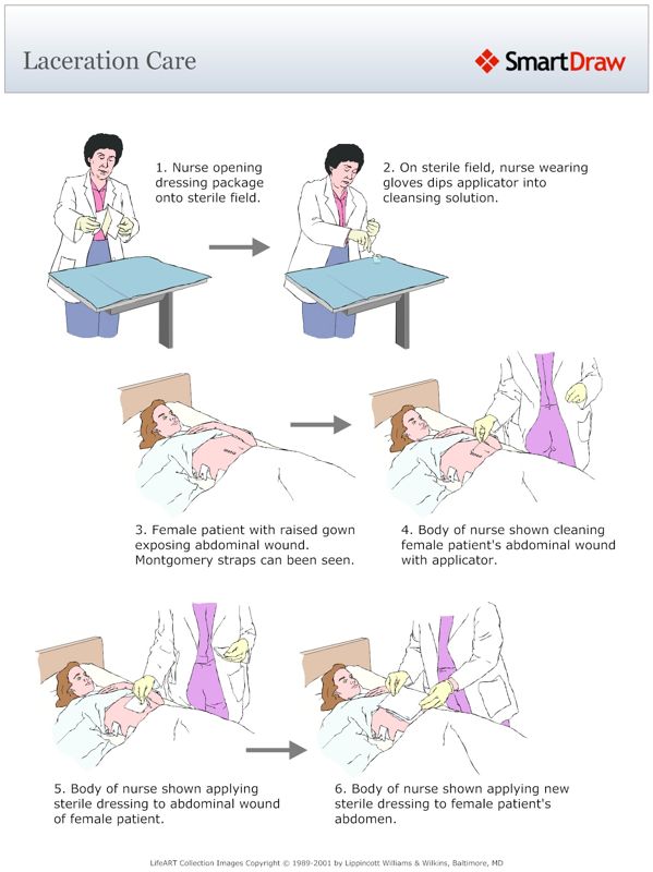 Laceration_Care