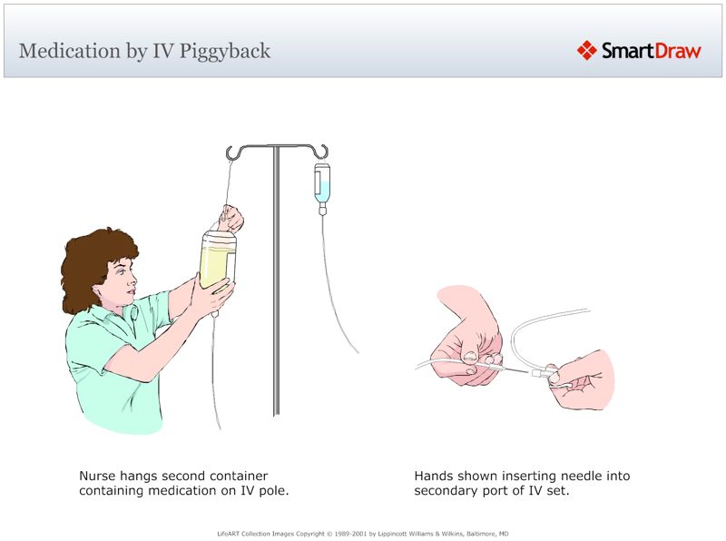 Medication_by_IV_Piggyback