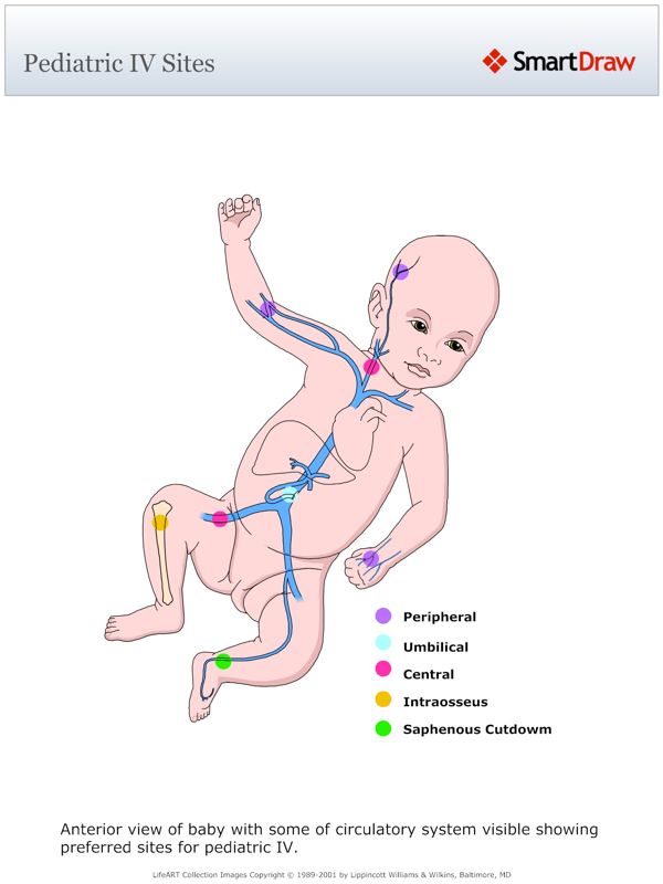 Pediatric_IV_Sites