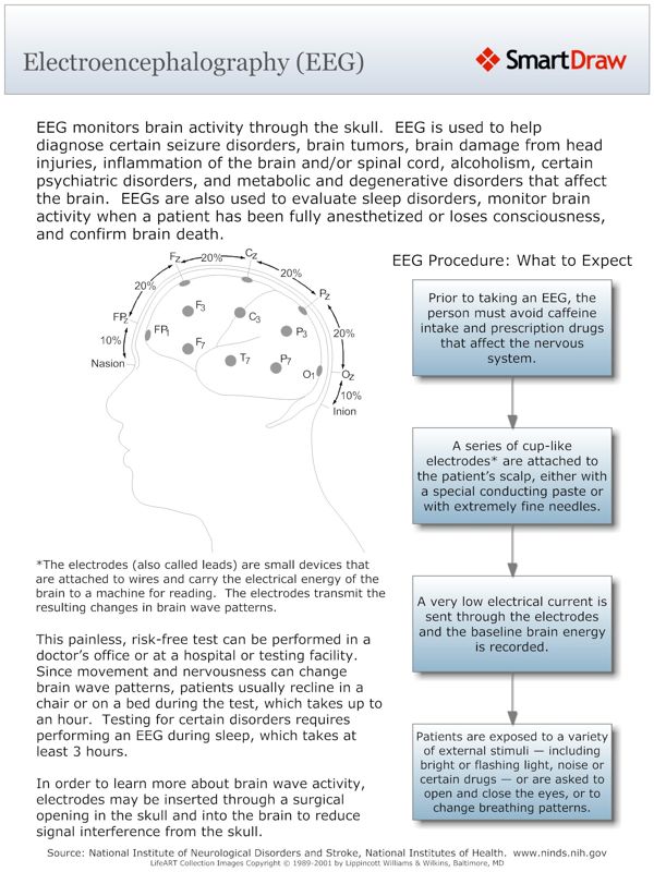 Electroencephalography_(EEG)