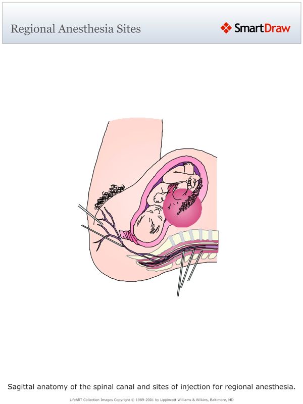 Regional_Anesthesia_Sites